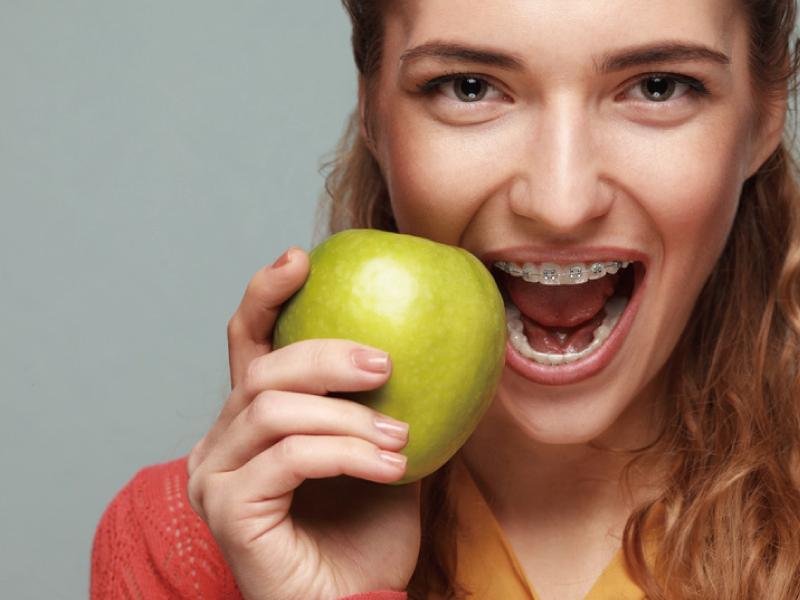 Orthodontics in Yokosuka
